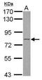 Plakophilin 1 antibody, PA5-29098, Invitrogen Antibodies, Western Blot image 