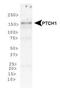 Patched 1 antibody, PA5-23083, Invitrogen Antibodies, Western Blot image 