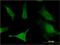Solute Carrier Family 6 Member 16 antibody, H00028968-M13, Novus Biologicals, Immunocytochemistry image 
