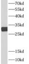 Nerve Growth Factor antibody, FNab10116, FineTest, Western Blot image 