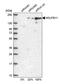 NADH:Ubiquinone Oxidoreductase Subunit B11 antibody, PA5-56449, Invitrogen Antibodies, Western Blot image 