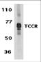 Interleukin 27 Receptor Subunit Alpha antibody, 2483, ProSci, Western Blot image 