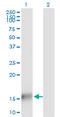 Tubulin Folding Cofactor A antibody, LS-C198304, Lifespan Biosciences, Western Blot image 