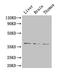 Hepatitis A Virus Cellular Receptor 1 antibody, CSB-PA09995A0Rb, Cusabio, Western Blot image 