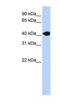 Deoxyribonuclease 2 Beta antibody, NBP1-62278, Novus Biologicals, Western Blot image 