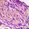 Insulin Receptor Substrate 1 antibody, LS-C358786, Lifespan Biosciences, Immunohistochemistry paraffin image 