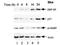 Zinc Finger Protein 148 antibody, A04433, Boster Biological Technology, Western Blot image 