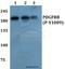Platelet Derived Growth Factor Receptor Beta antibody, A00096Y1009, Boster Biological Technology, Western Blot image 