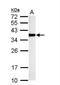 Thiosulfate Sulfurtransferase antibody, NBP1-33771, Novus Biologicals, Western Blot image 
