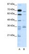 Proprotein Convertase Subtilisin/Kexin Type 6 antibody, orb329644, Biorbyt, Western Blot image 