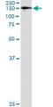 WW Domain Containing E3 Ubiquitin Protein Ligase 1 antibody, H00011059-M01, Novus Biologicals, Immunoprecipitation image 