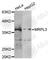 Mitochondrial Ribosomal Protein L3 antibody, A5966, ABclonal Technology, Western Blot image 