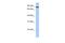 Transmembrane And Tetratricopeptide Repeat Containing 1 antibody, A13970, Boster Biological Technology, Western Blot image 