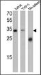 CD99 Molecule (Xg Blood Group) antibody, MA5-12954, Invitrogen Antibodies, Western Blot image 