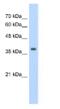 Tropomyosin 1 antibody, ab55915, Abcam, Western Blot image 