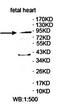 Zinc Finger Protein 786 antibody, orb78264, Biorbyt, Western Blot image 