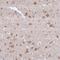 Microtubule Associated Protein 1A antibody, NBP1-82801, Novus Biologicals, Immunohistochemistry frozen image 