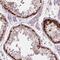 LSM Family Member 14B antibody, NBP2-56828, Novus Biologicals, Immunohistochemistry paraffin image 