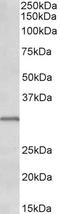 Insulin Like Growth Factor Binding Protein 1 antibody, LS-B10400, Lifespan Biosciences, Western Blot image 