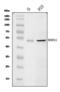 SRY-Box 11 antibody, A02603-3, Boster Biological Technology, Western Blot image 
