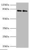 Complement Factor B antibody, A55575-100, Epigentek, Western Blot image 
