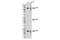 Calcium/Calmodulin Dependent Protein Kinase Kinase 2 antibody, 12818S, Cell Signaling Technology, Western Blot image 