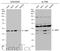 S-Phase Kinase Associated Protein 2 antibody, GTX133767, GeneTex, Western Blot image 