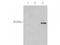 Inhibitor Of Growth Family Member 5 antibody, TA319227, Origene, Western Blot image 