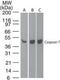 Caspase 7 antibody, MA1-41281, Invitrogen Antibodies, Western Blot image 