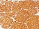 Tyrosinase antibody, NBP2-44683, Novus Biologicals, Immunohistochemistry frozen image 