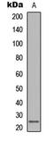 Lymphotoxin Beta antibody, LS-C356159, Lifespan Biosciences, Western Blot image 