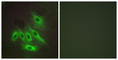 Mucin 16, Cell Surface Associated antibody, abx013727, Abbexa, Western Blot image 