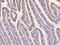 Interleukin 23 Subunit Alpha antibody, 310619-T08, Sino Biological, Immunohistochemistry frozen image 