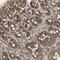 Murine Retrovirus Integration Site 1 Homolog antibody, NBP1-87877, Novus Biologicals, Immunohistochemistry paraffin image 