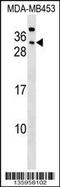 Carcinoembryonic Antigen Related Cell Adhesion Molecule 7 antibody, 58-984, ProSci, Western Blot image 