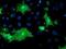 Oxysterol Binding Protein antibody, NBP2-00935, Novus Biologicals, Immunofluorescence image 