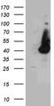 Haptoglobin-related protein antibody, LS-C796637, Lifespan Biosciences, Western Blot image 