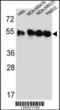 Tubulin Beta 4B Class IVb antibody, 61-802, ProSci, Western Blot image 