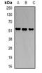 Hydroxymethylbilane Synthase antibody, abx141630, Abbexa, Western Blot image 