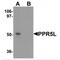 Proline Rich 5 Like antibody, MBS150786, MyBioSource, Western Blot image 