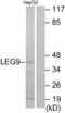 Galectin 9 antibody, LS-B6275, Lifespan Biosciences, Western Blot image 