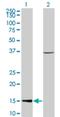 Chromatin Accessibility Complex Subunit 1 antibody, H00054108-M05, Novus Biologicals, Western Blot image 