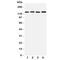 Tight Junction Protein 2 antibody, R31077, NSJ Bioreagents, Western Blot image 