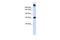 Sucrase-Isomaltase antibody, 26-014, ProSci, Western Blot image 