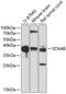 Sodium Voltage-Gated Channel Beta Subunit 4 antibody, 18-539, ProSci, Western Blot image 
