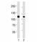 MutS Homolog 2 antibody, F52414-0.4ML, NSJ Bioreagents, Western Blot image 