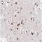 C-Type Lectin Domain Family 3 Member A antibody, NBP2-30595, Novus Biologicals, Immunohistochemistry frozen image 