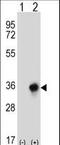 Carbonyl Reductase 3 antibody, LS-C168356, Lifespan Biosciences, Western Blot image 