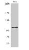 Eukaryotic Elongation Factor 2 Kinase antibody, A02277S366-2, Boster Biological Technology, Western Blot image 