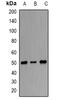 Origin Recognition Complex Subunit 4 antibody, abx142117, Abbexa, Western Blot image 